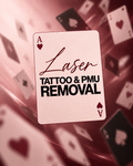 Tattoo & PMU Removal — Laser