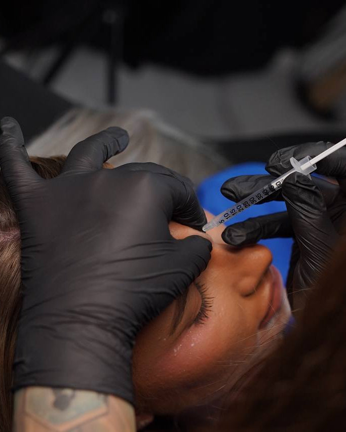 Anti-Wrinkle Treatment — 3 Areas
