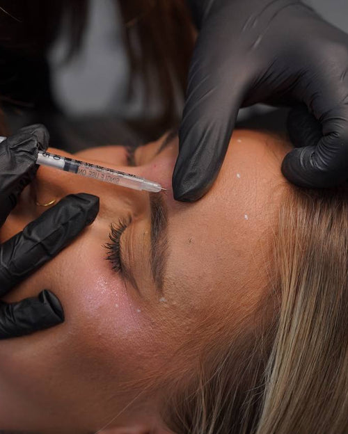 Anti-Wrinkle Treatment — 3 Areas