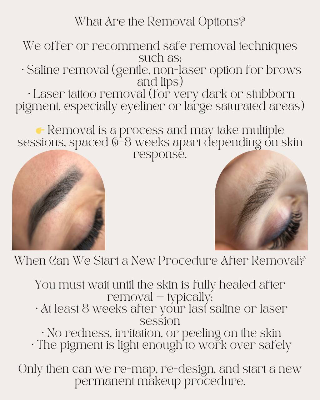 Pigment Removal — Chemical