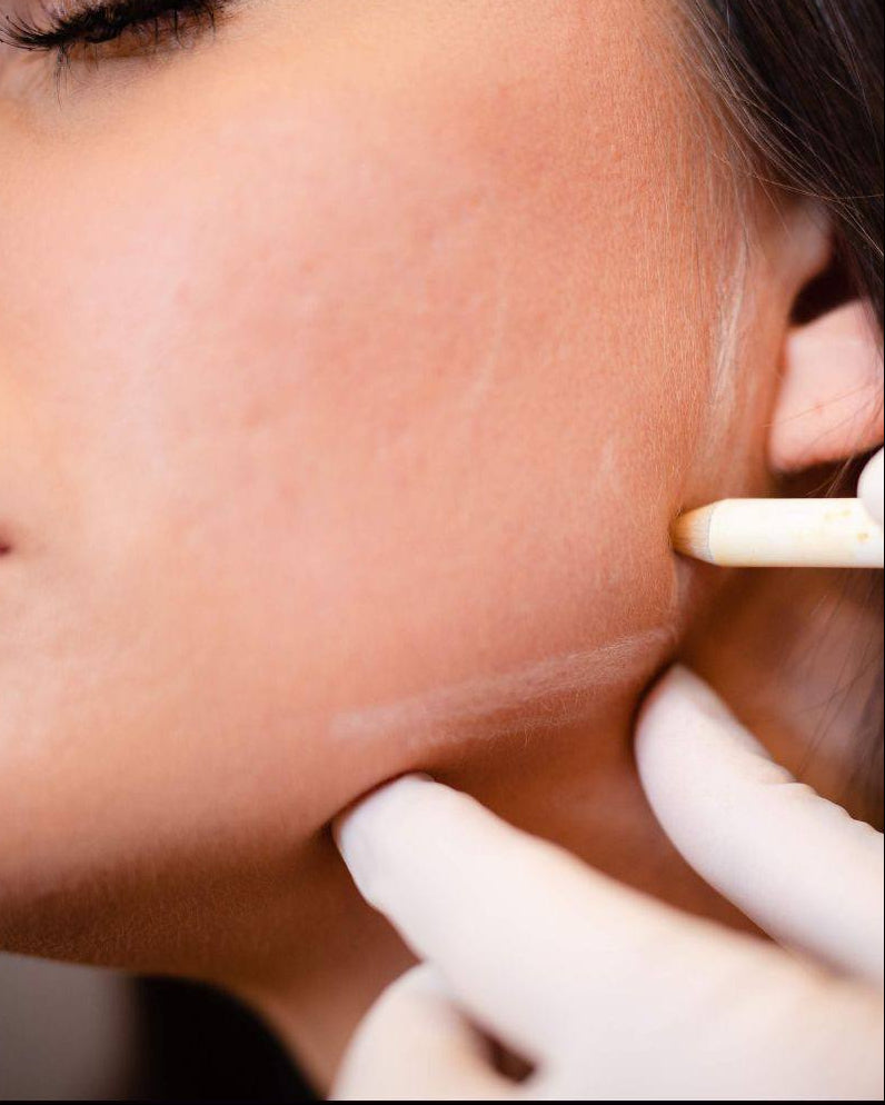 Face Contouring — Jawline Slimming